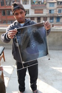 Lunge röntgen beim medizinischen Check Up